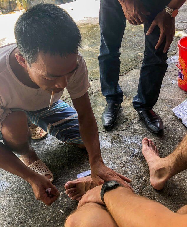 Mark having a leech removed in Vietnam hiking tips for beginners
